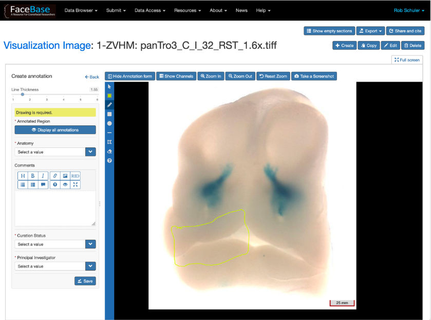 Scan of Brain in FaceBase Software